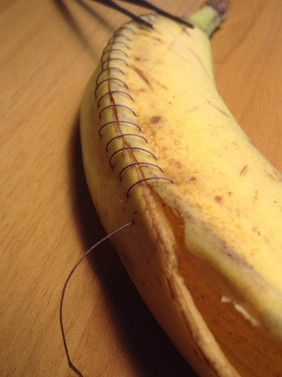 David_ukan's tweet photo. Professional athletes, musicians etc. train hard between the events in order to achieve a flawless execution and performance. So must do a surgeon!  ‘Repetita Iuvant’. Perfect stitching from BBASS follower.  🙏👍 https://t.co/EYmNbnKbgK