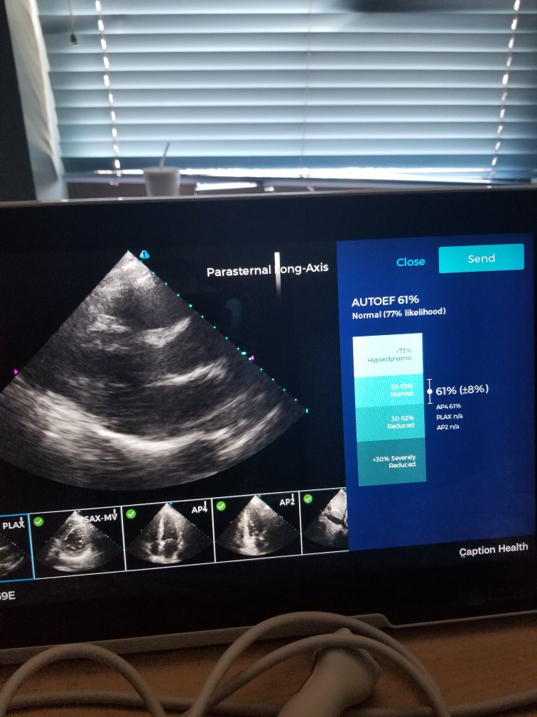 UAZTucson_IMRes's tweet photo. Capturing the future of medicine with Caption Health's AI Ultrasound technology. #POCUS 
Thanks to PD @BAinapurapu for coordinating. Dr. Blackstone learning new skills. 

#MedEd #MedTech #MedTwitter https://t.co/5UsEUldwv7