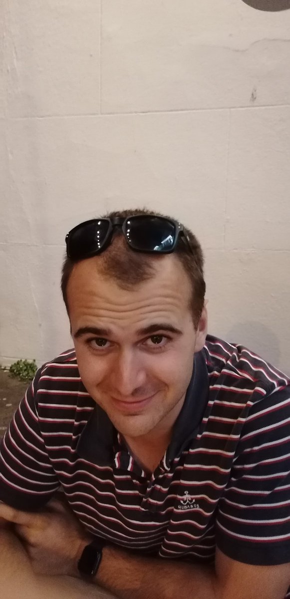 PMCarter7's tweet image. My mate is unsure whether to shave his lid. 100 retweets and he says he will... Do your thing #retweet #hottestdayoftheyear #NewBarnet #Haircut #lidremoval