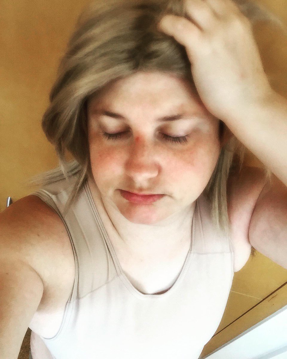 Ordonianhero's tweet photo. Got a few bug bites from sleeping outdoors, but isn’t that what summer is like?! Welcome summer in Ordon village. Mosquitos have arrived. #linkeduniverse #twilightprincess #loz #cosplay #legendofzelda #herooftwilight https://t.co/00ps9zZ59K