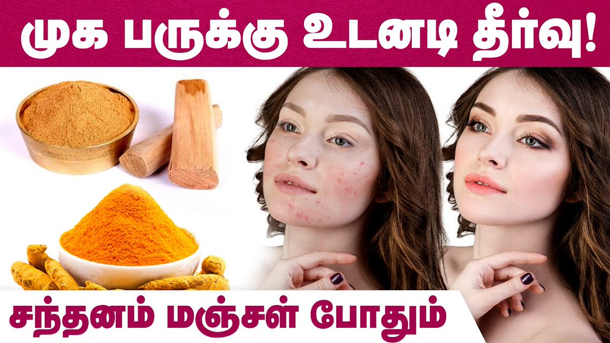 IbcMangai's tweet image. சந்தனம், மஞ்சள் போதும் முகப்பரு காணாமல் போக | Remedy For Pimple | Pimples Removal on Face at Home

Video Link --&amp;gt; youtu.be/0kdmO7-e7QE

#Pimples #Face #PimplesTreatment #IBCMangai #Beauty #TamilTips