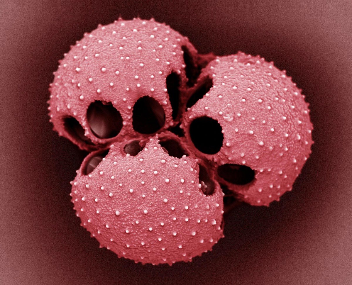 These are the pollen grains of the venus flytrap. 

(Dionaea muscipula)
Photo: Kevin Mackenzie