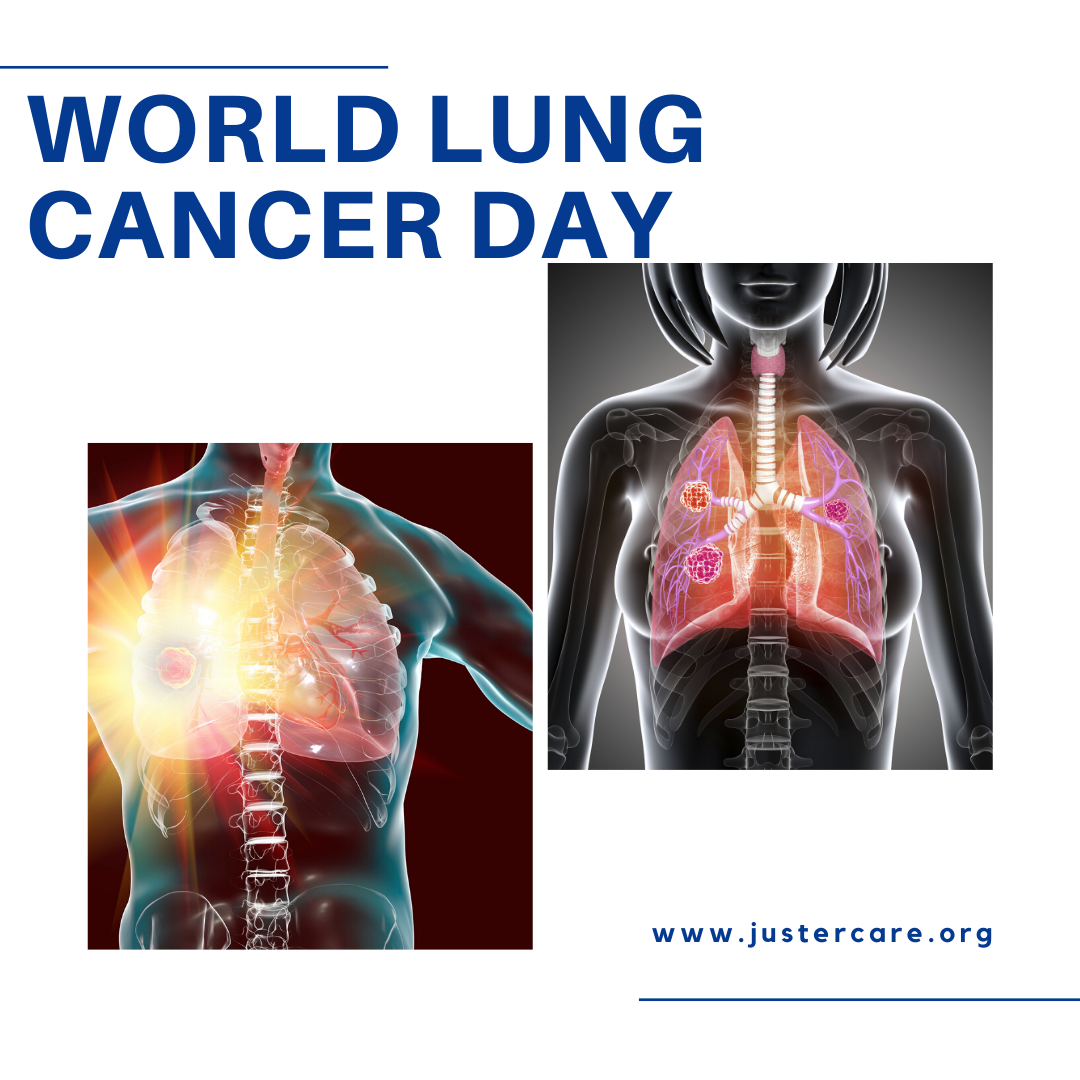 JusterCare's tweet photo. Today is the World's Lung Cancer Day! 
Lung cancer continues to be one of the most common cancers worldwide, claiming more lives yearly than breast, colon and prostate cancers combined. 
You can help! Pass on this message!
#WorldLungCancerDay #LungCancerDay #justercare https://t.co/O03tu2m2LH