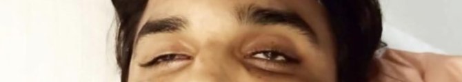  Possiblity of drug..If we look at Sushant eye ..It seems either he taken some kind of drug or something given to him. (Pic)Also I wanted to highlight that I have not find any sign of struggle. (Damage in body parts, specially hands..) #UddhavResignOrCBI4SSR