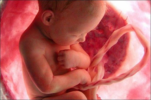 AdePouchol's tweet photo. Il faut oser regarder en face la réalité de l'#avortement. L'IMG possible jusqu'au dernier mois de grossesse, c'est un permis de tuer des petits d'homme comme celui-ci : https://t.co/fsZCdkwkyg