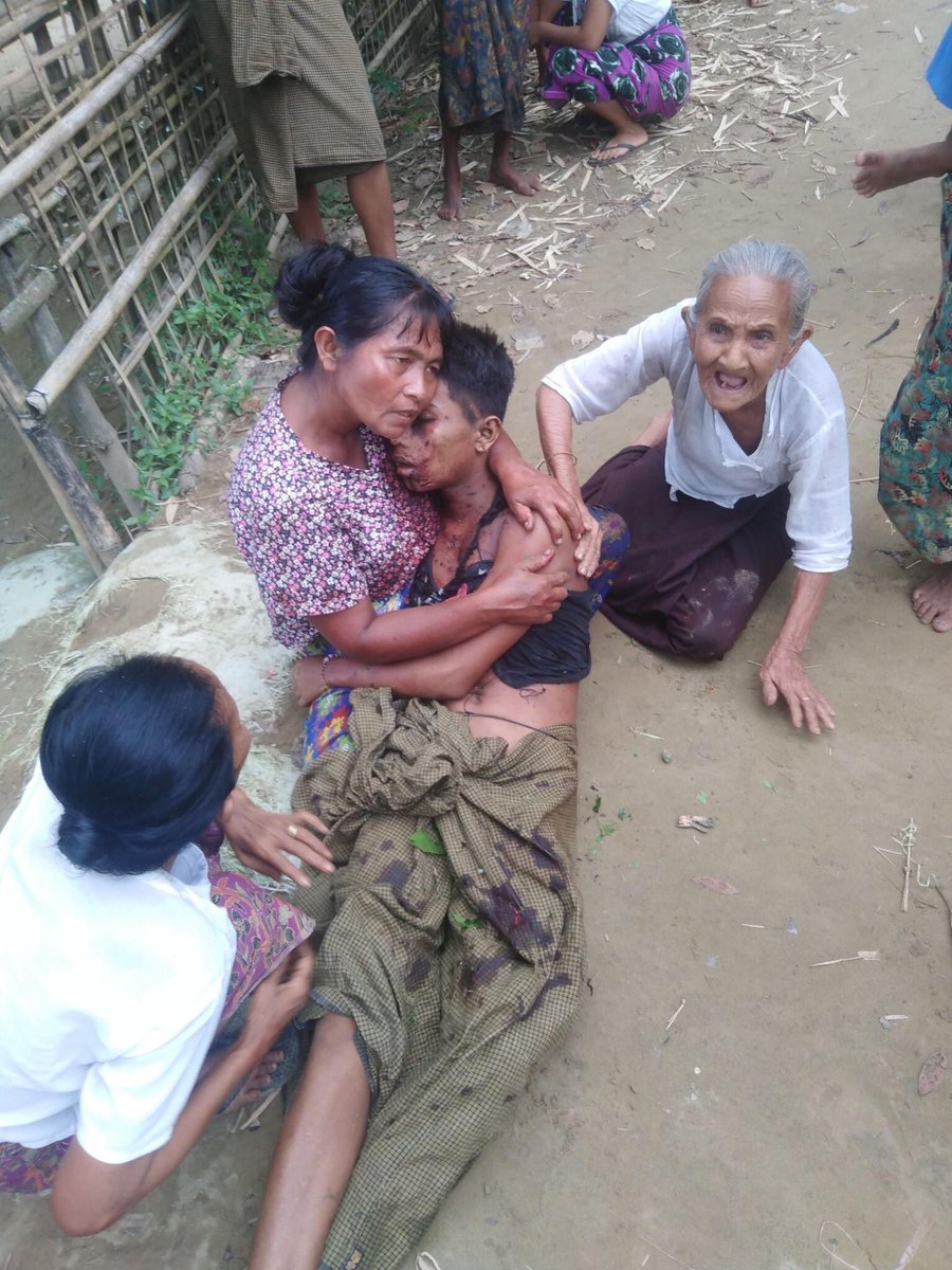 wong_htun's tweet photo. Landmines killed 4 civilians and injured 5 villagers in this week in Rakhine State, Myanmar. Landmines are planted everywhere that are killing civilian populations daily and impact on personal safety and community security.

 https://t.co/8EO9nxw0qG

@hrw @UN @FortifyRights @AP https://t.co/bESJRlUZTp
