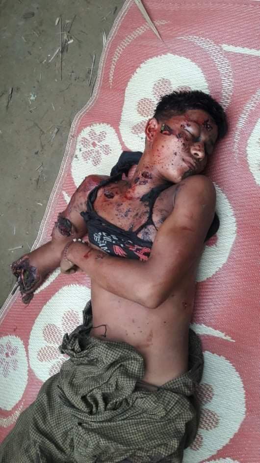 ChitthuSky's tweet photo. 1 villagers were killed and four childrens were injured in a bomb blast between Burmese Army insurgents in Moe Se Kyun Kap Chaung village and Kan Pyin village in Rathedaung Township.

1.8.2020 https://t.co/V3Opg9NOnW