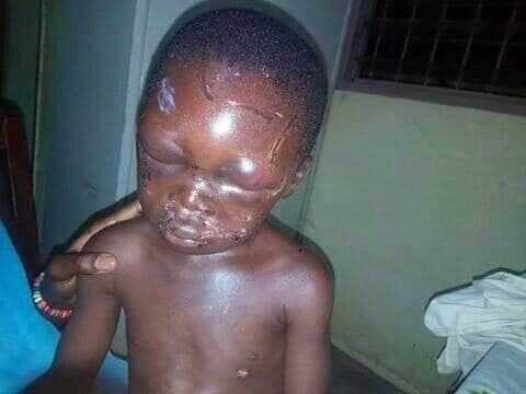 Gidi_Traffic's tweet photo. “@NewsTrackerNG: The Law Enforcement Agents should Act on this case as a matter of urgency 

Shocking pictures of a 7 yr old boy severely beaten by his step father after eating part of rice beans that was left for supper.
@Gidi_Traffic https://t.co/1geUM7OL8N
