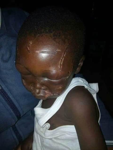 Gidi_Traffic's tweet photo. “@NewsTrackerNG: The Law Enforcement Agents should Act on this case as a matter of urgency 

Shocking pictures of a 7 yr old boy severely beaten by his step father after eating part of rice beans that was left for supper.
@Gidi_Traffic https://t.co/1geUM7OL8N