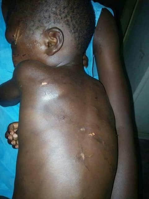 Gidi_Traffic's tweet photo. “@NewsTrackerNG: The Law Enforcement Agents should Act on this case as a matter of urgency 

Shocking pictures of a 7 yr old boy severely beaten by his step father after eating part of rice beans that was left for supper.
@Gidi_Traffic https://t.co/1geUM7OL8N