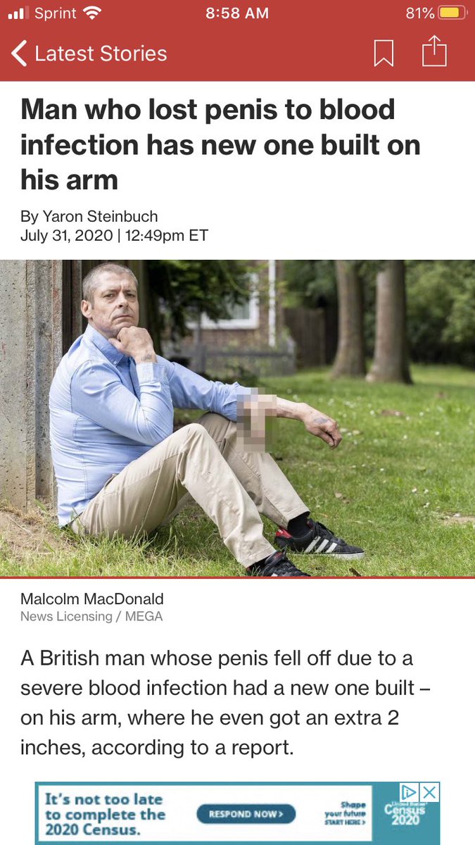just in case you didn’t read the paper today

I love the blur mark on his arm Penis