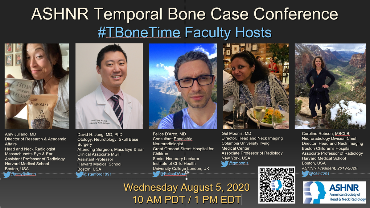 callyrobs's tweet photo. Listen up Temporal Bone Enthusiasts! Join @amyfjuliano @gmoonis @FeliceDArco, guest panelist @stanford1891 &amp; me for the mostly monthly #TBoneTime Case Conf this Wed Aug 5 1PM EST. @ASHNR - the society that keeps on giving! #Raded #FOAMrad #NeuroRad Register using QR code below https://t.co/dMnv5PaspQ