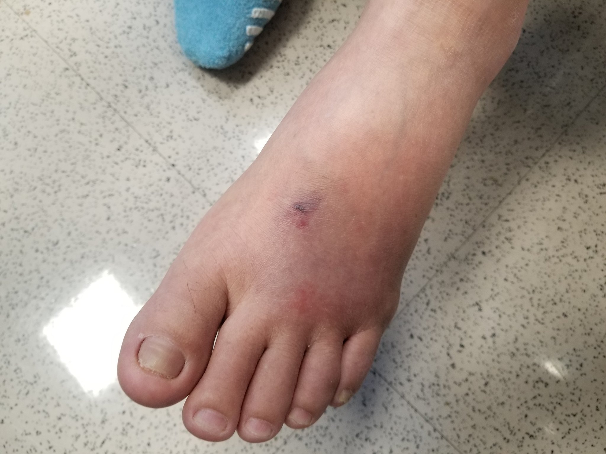 Eric Lee, MD on Twitter: "I still see many things for the first time even  as an attending. Stingray attack in Brooklyn. Think back to the marine  envenomation chapter in Rosen\