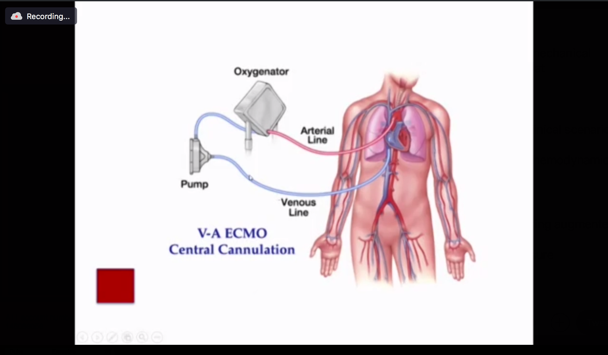 VA ECMOReplaces  & Adjust FiO2:  oxygenationAdjust sweep speed:  ventilationWatershed area: Where blood pumped by native  mixes with ECMO blood - matters where ABG is drawn from afterload - must ensure LV vented and AV opening to avoid catastrophe!