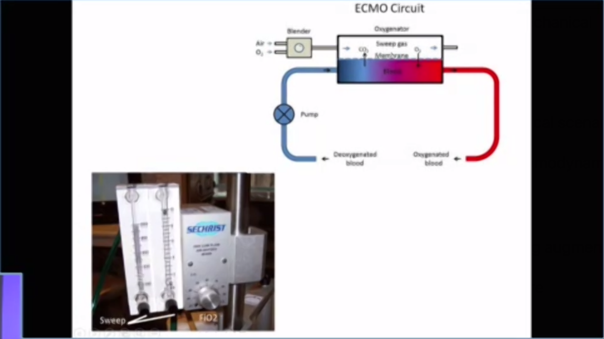 VA ECMOReplaces  & Adjust FiO2:  oxygenationAdjust sweep speed:  ventilationWatershed area: Where blood pumped by native  mixes with ECMO blood - matters where ABG is drawn from afterload - must ensure LV vented and AV opening to avoid catastrophe!