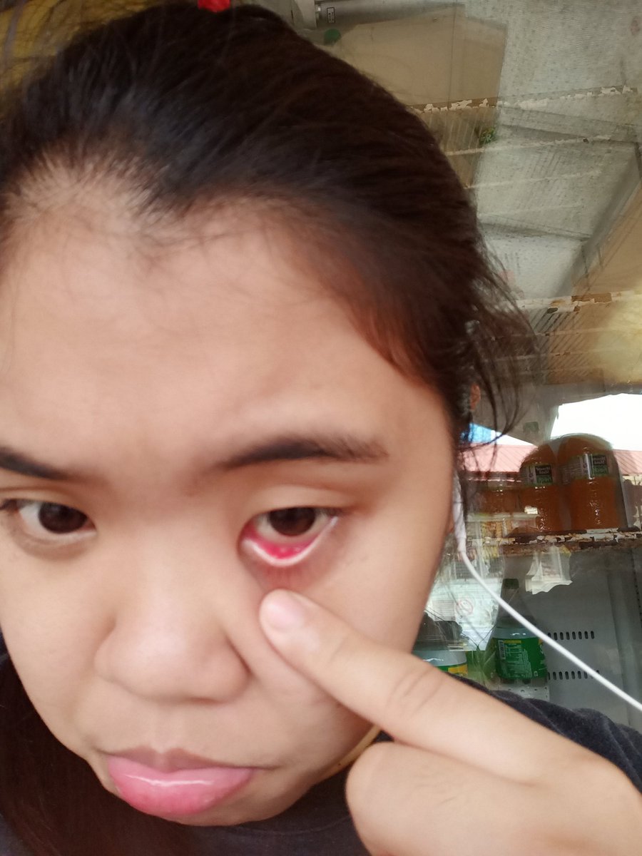 superdenniece's tweet photo. Kuliti. 🥴 https://t.co/5OyQJaYPS6