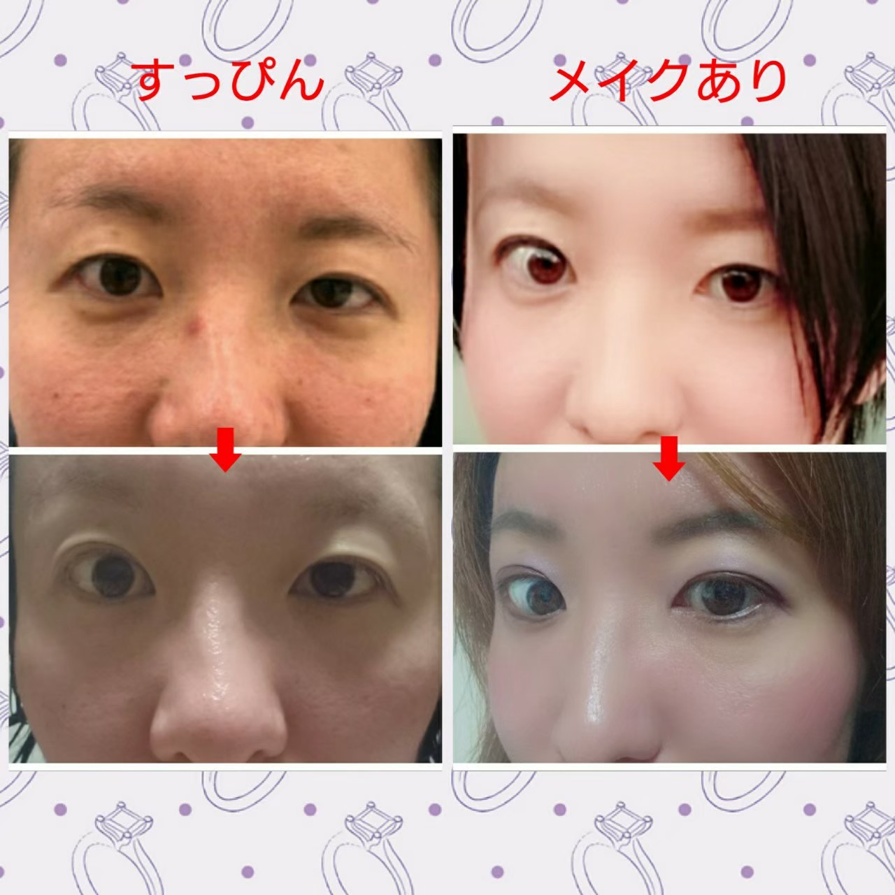 Arita Rtえっそんな名前が 知らなかった ガチャ目とどう違うんだ 自分雌雄眼と思っていい それだったら自己肯定感爆上がり案件だけど Arita Rtえっそんな名前が 知らなかった ガチャ目とどう違うんだ 自分雌雄眼と思っていい それだったら自己肯定感爆上がり案件だけど