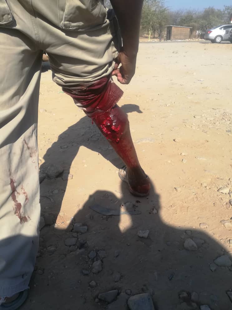 sicha2015's tweet photo. As we remember the #Aug1 victims lets hve Edmond from Beitbridge who is currently nursing his leg after #policedog was set on him at Engene garage yesterday at around 4pm. Hez currently on admission at bb hospital @citezw @ZLHRLawyers @lindampofu  @Mamoxn https://t.co/JzSWE7EcCk