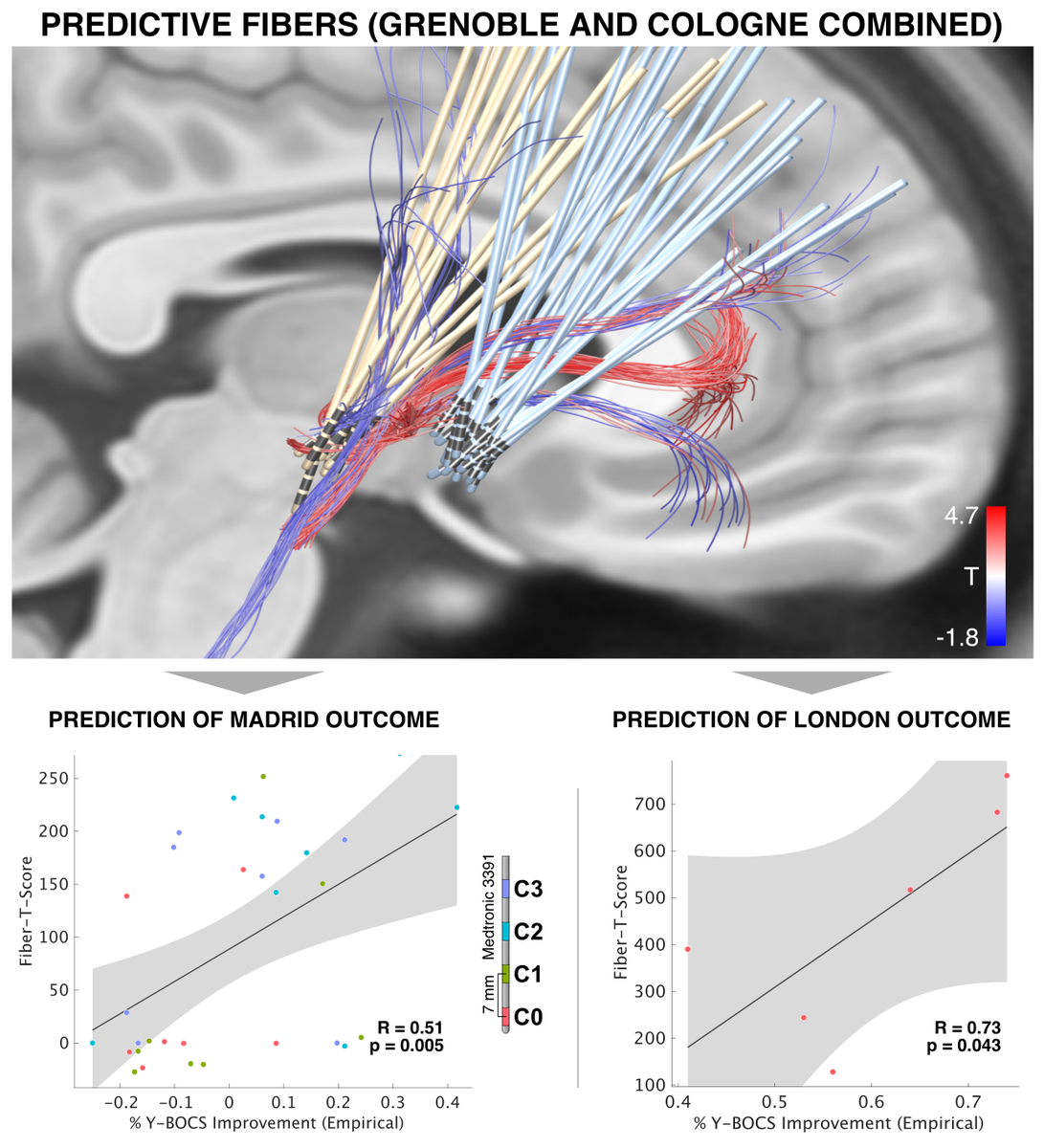 This claim is a hypothesis, as well, backed by but a bit of empirical data.First, we reproduced connectome findings using a holographic atlas of the brain which shows an accurate description of the limbic hyperdirect pathway.