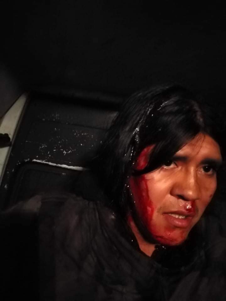 ObservatorioDHP's tweet photo. 1 de agosto alrededor de las 21 h urbas de facistas y caravineros atacaron tres ocupaciones de municipios en donde estaban las comunidades mapuches movilizandose por la libertad de los prisioneros políticos
Exigimos al Estado chileno
Alto a la represión 
@ONU_es 
@sebastianpinera https://t.co/zV61jHmUQp
