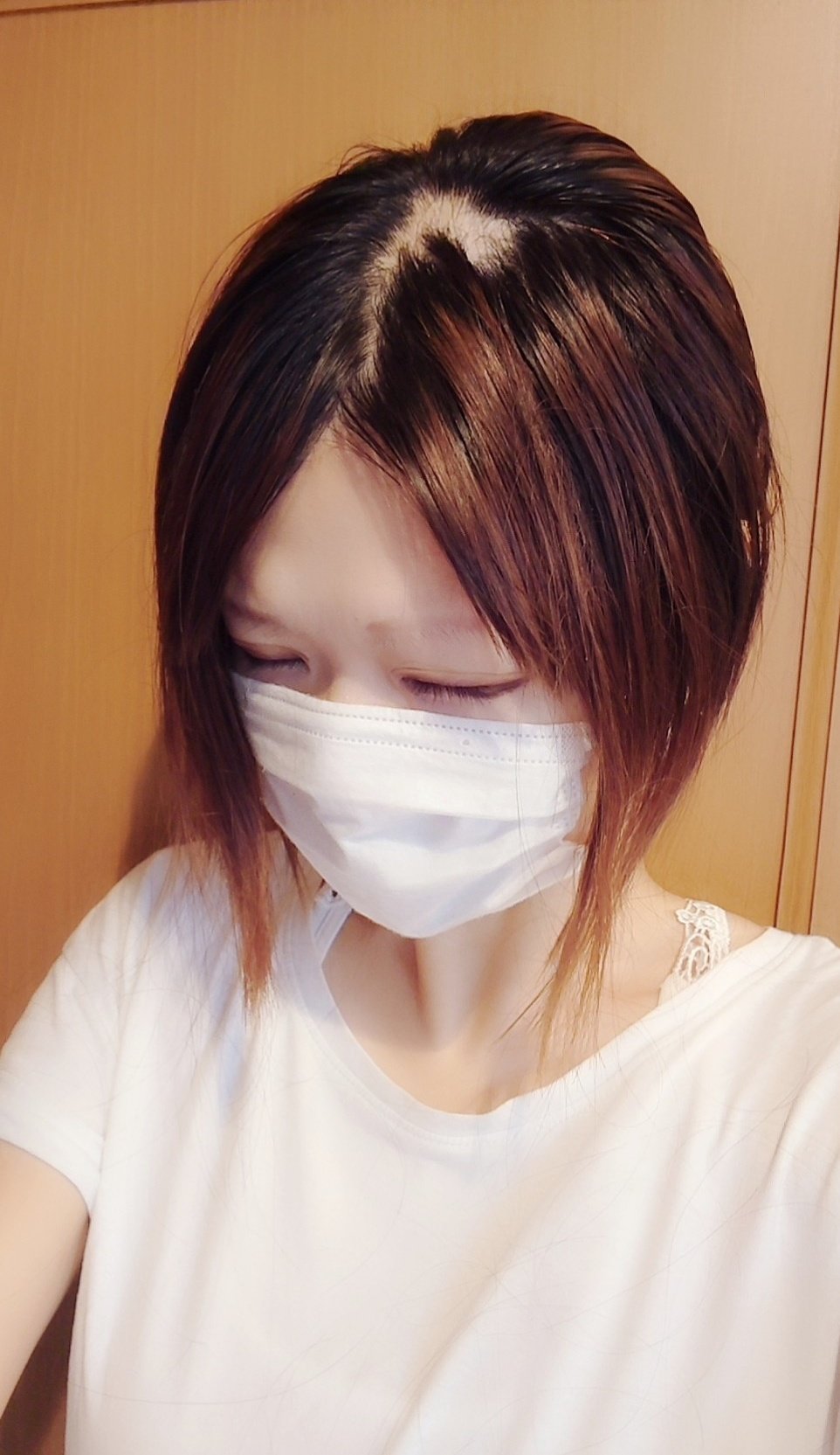 Shal The Uncrowned 画像注意 抗がん剤から17日目 髪がゴソッと抜けた 髪は抜けるけど 食欲が出てきて美味しくご飯を食べられるから 幸せだ 食に感謝 そして髪の抜けた部分を触るとスベスベしてて何だか気持ち良いのだ 笑 体調は良好 夕方涼しく