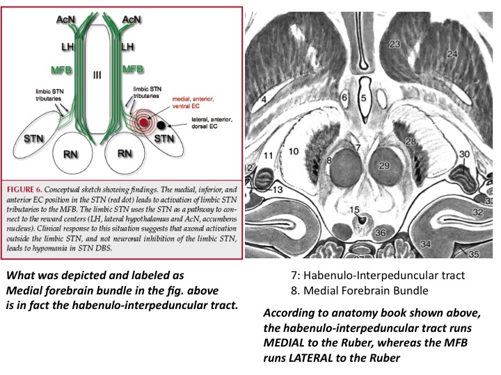 Already in the original publication, it remains a bit ambiguous whether the shown tract is really the MFB (which usually is lateral to the red nucleus e.g. as defined by Nieuwenhuys et al in their excellent anatomy handbook). This slide was shared w/ me by a colleague: