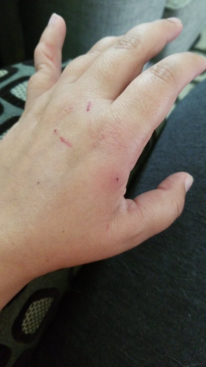 Phoenix28432828's tweet photo. @JacksonGalaxy So this happened while trying to leash train my cat. Something spooked her and i was going to get bit or she was going to strangle herself. https://t.co/cXl5a05vgr