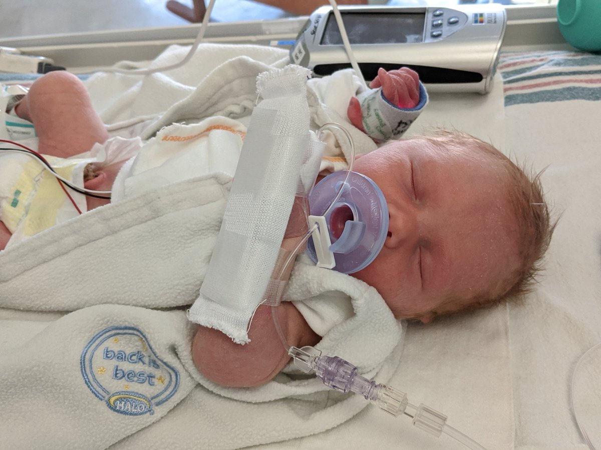 emmybeanz's tweet photo. Welcome Thomas Jack "TJ" to the boy crew.
#preemiebaby #35weeker #nicubaby #babyboy4 https://t.co/TrHynjbnAp