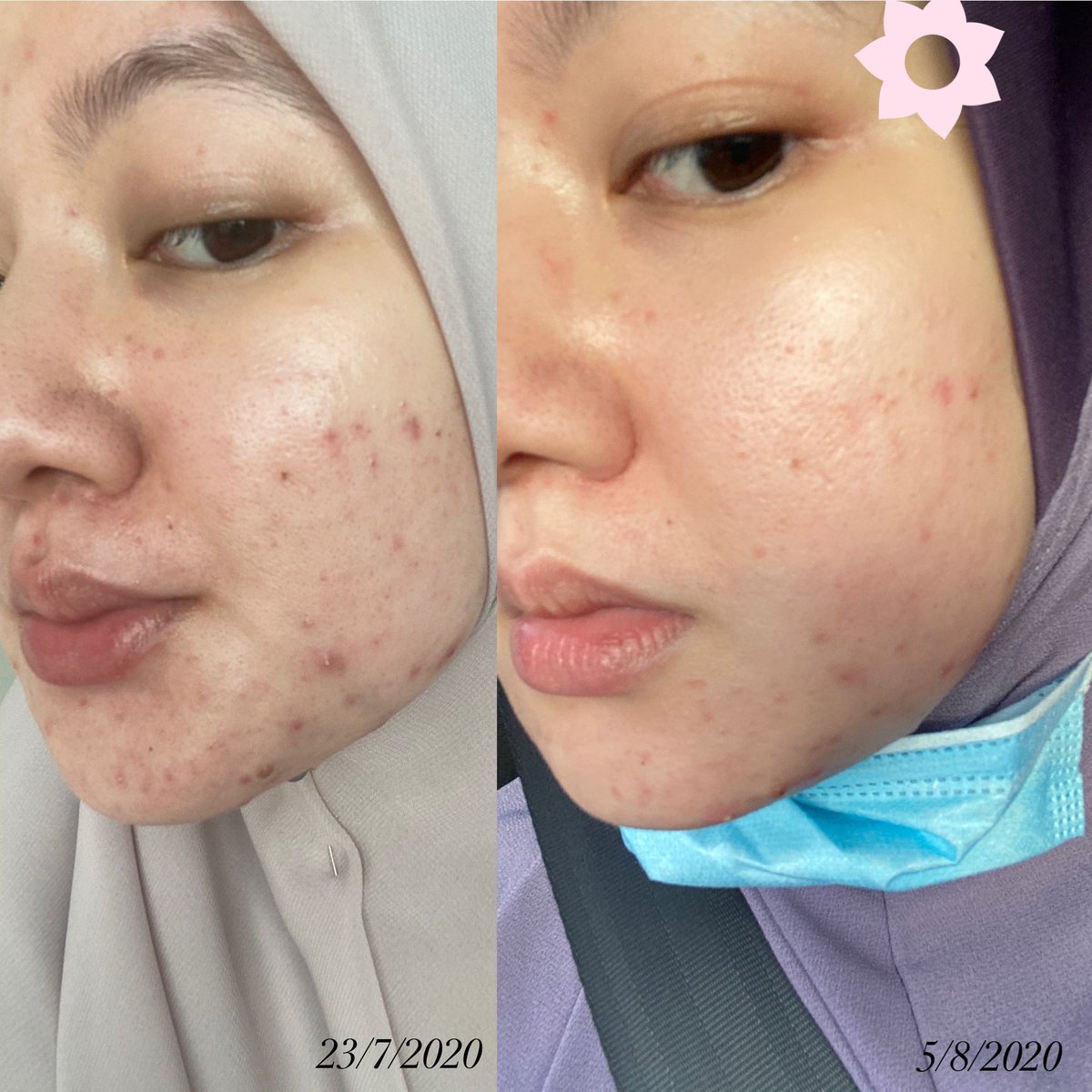 Hello! Finally my skincare routine yang I hutang haritu. Sebab banyak benda I kena baca dan kena letak disclaimer, so I taknak buat thread separuh siap. So here it is. Thank you for waiting! You’re the real MVP 