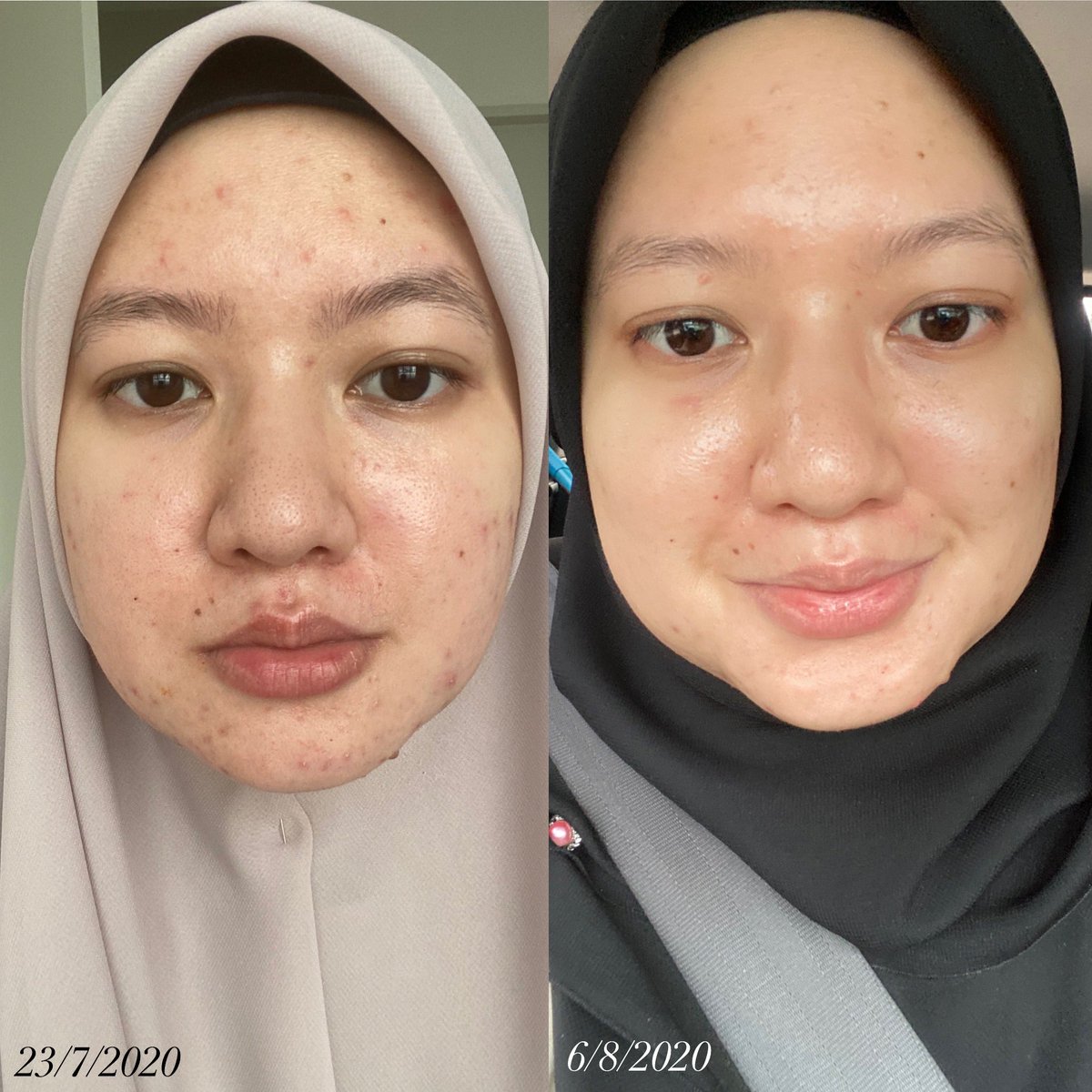 Hello! Finally my skincare routine yang I hutang haritu. Sebab banyak benda I kena baca dan kena letak disclaimer, so I taknak buat thread separuh siap. So here it is. Thank you for waiting! You’re the real MVP 
