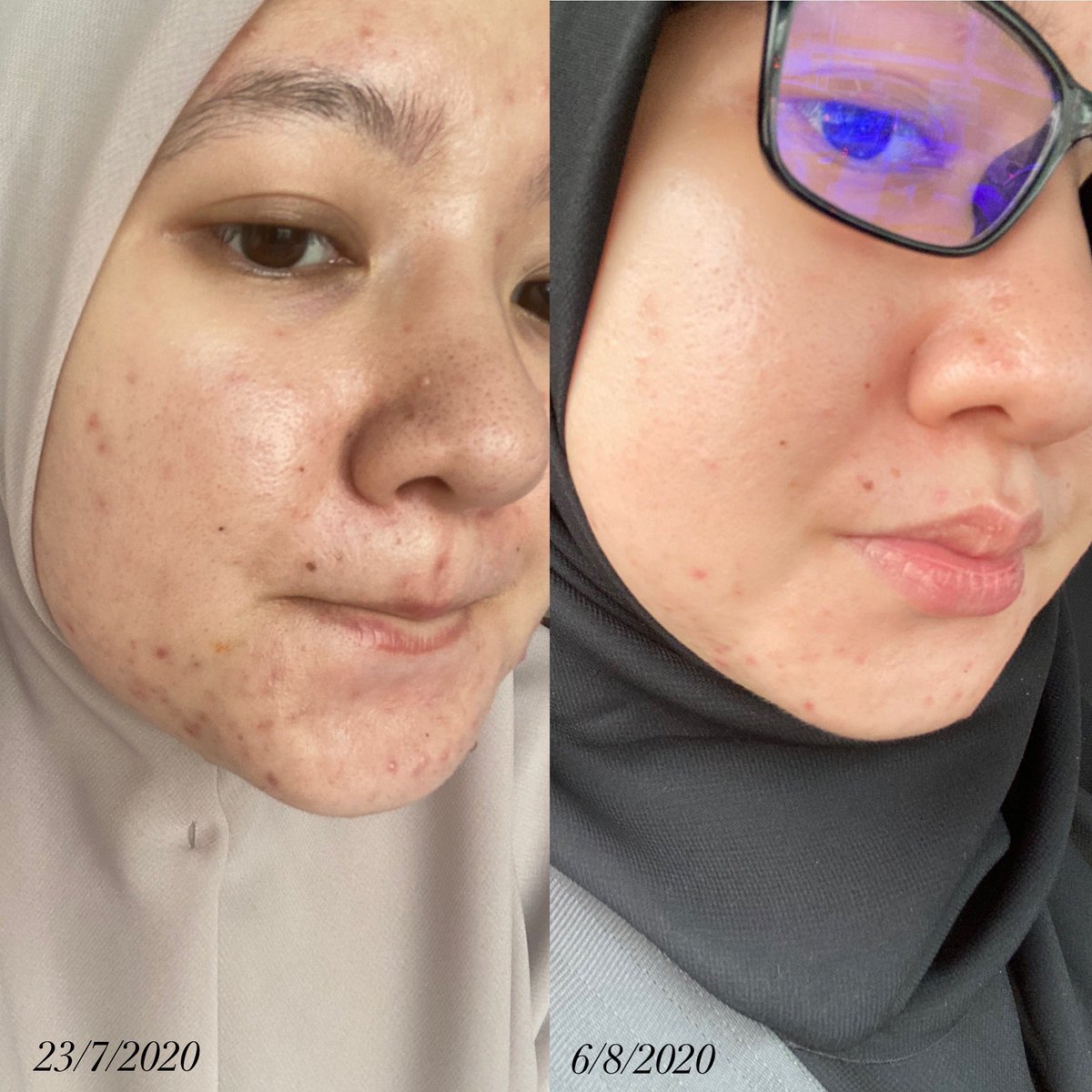 Hello! Finally my skincare routine yang I hutang haritu. Sebab banyak benda I kena baca dan kena letak disclaimer, so I taknak buat thread separuh siap. So here it is. Thank you for waiting! You’re the real MVP 