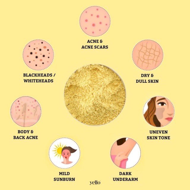  Apa yang I pakai and why I choose to use the products. The first one is OTMS by  @yelloskincarehq I use this untuk treat acne, utk parut jerawat and blackhead as well. Untuk whitehead I guna AHA toner by Jumiso.