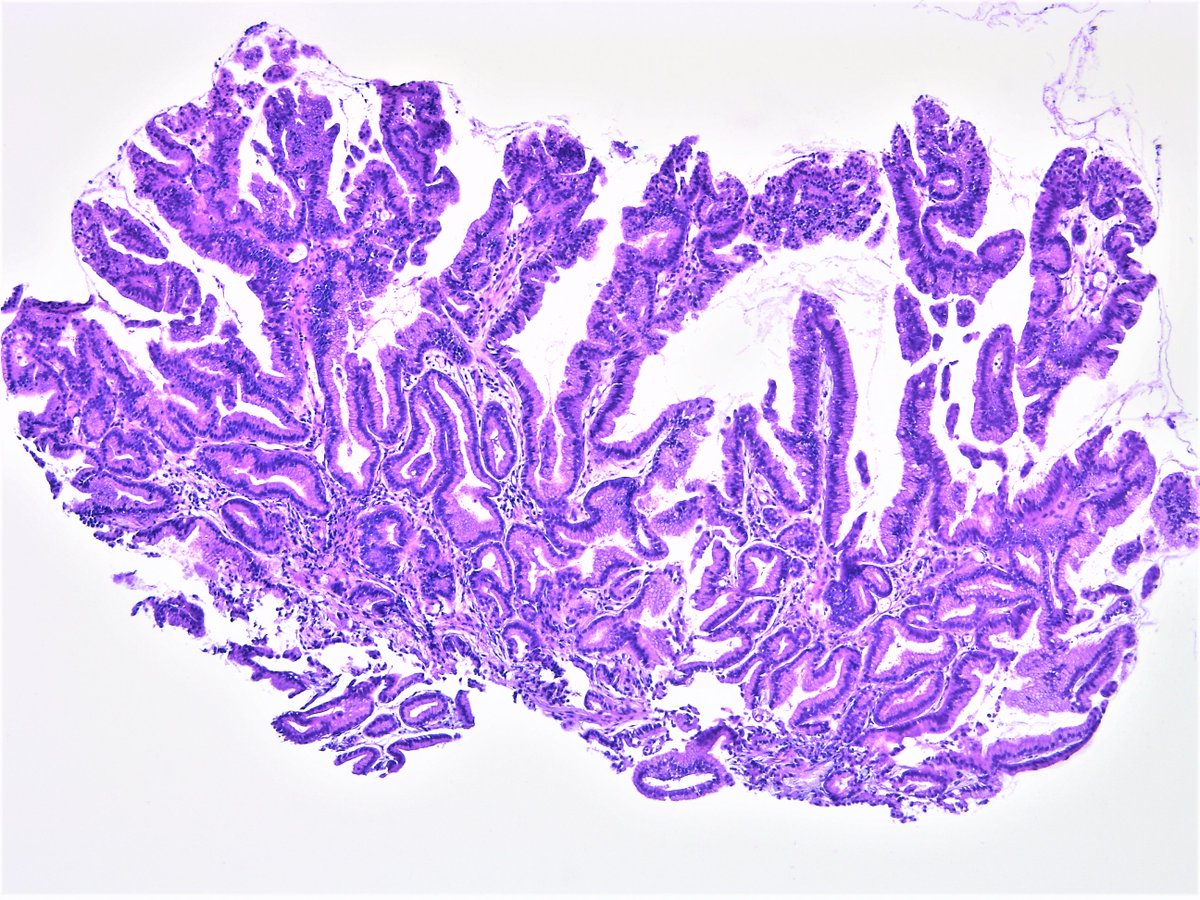 Pathology Walker@Auto Tweet Bot tweet media