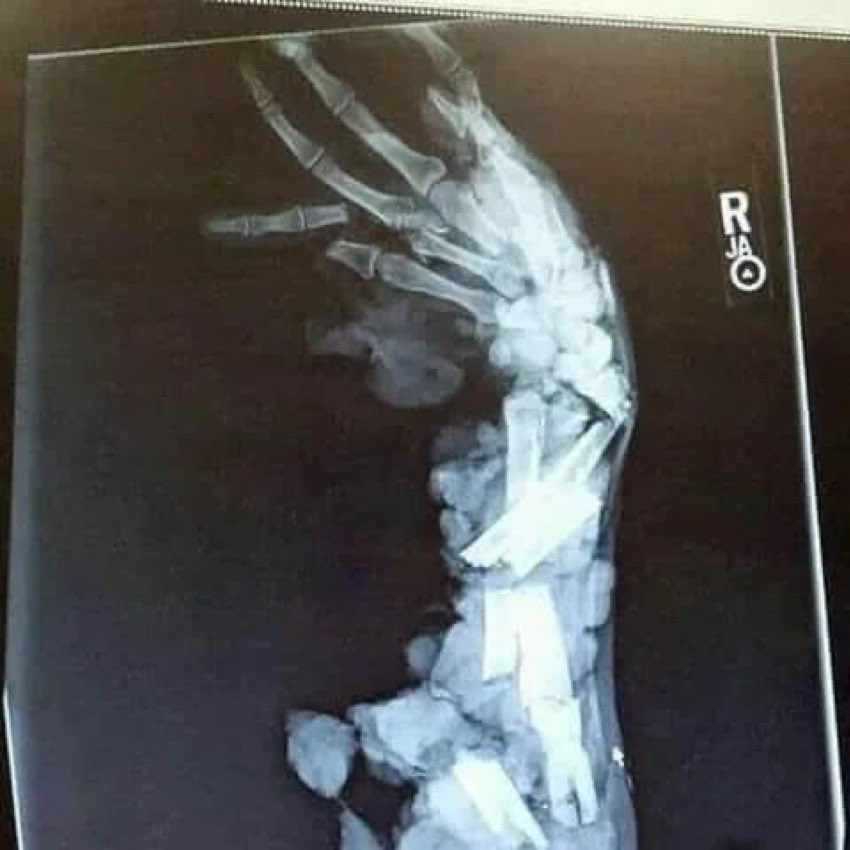DrGolfShirt's tweet photo. ER doc: Who is on call for hand? 

Plastics: Ortho. Call them. 

Ortho: Plastics. Call them. https://t.co/mDzscrTh7d