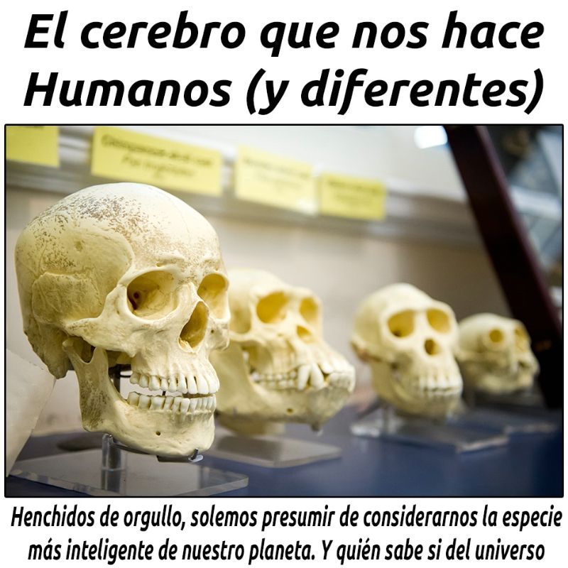 hosteleriaenvlc's tweet photo. EL CEREBRO QUE NOS HACE HUMANOS (Y DIFERENTES)

https://t.co/JDdsgEjUy0

@Conversation_E #TheConversationEspana #HosteleriaEnValencia #theconversation #Cerebro #Humanos #CerebroHumano #Inteligencia #Mamiferos #Evolucion #Neuronas #Genoma #Chimpances #SRGAP2 #FOXP2  #Microcefalia https://t.co/AguG9LtFXL