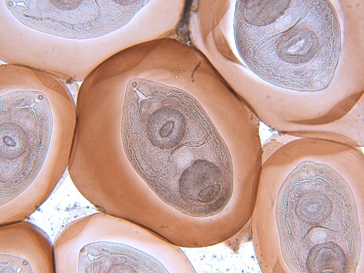 parazitologiecz's tweet photo. Yeah, #Leucochloridium sporocyst pretending to be a caterpillar is cool, but have you ever seen what is actually inside? 😱 
The stages inside are called cercarium and are more then ready to pass safely through the stomach to reach their final destination 🍩! https://t.co/VY1FOItQb9