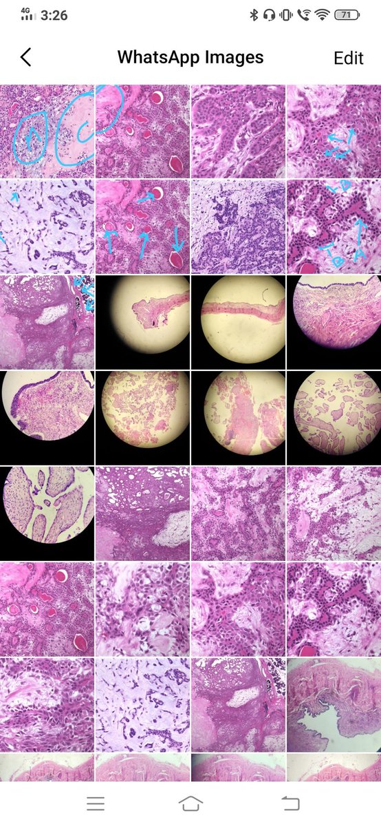 DrJashmine's tweet photo. My phone's gallery in first few days of life as first year Pathology resident be like. 
Life is Pink and Blue. 🔬 
#pathologylife https://t.co/YkktzYvIdC