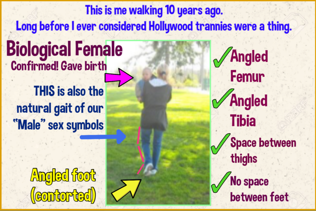 Bevvie112's tweet photo. THIS IS A LIVING THREAD

FTM-TG  requests-only will be posted here

Anthropologists examining remains in a Serbian mass grave had a 100% success rate in bio-sex determination

This will also be the sole criteria used IN THIS THREAD for requested EGI subjects https://t.co/fwE6PdQLYm
