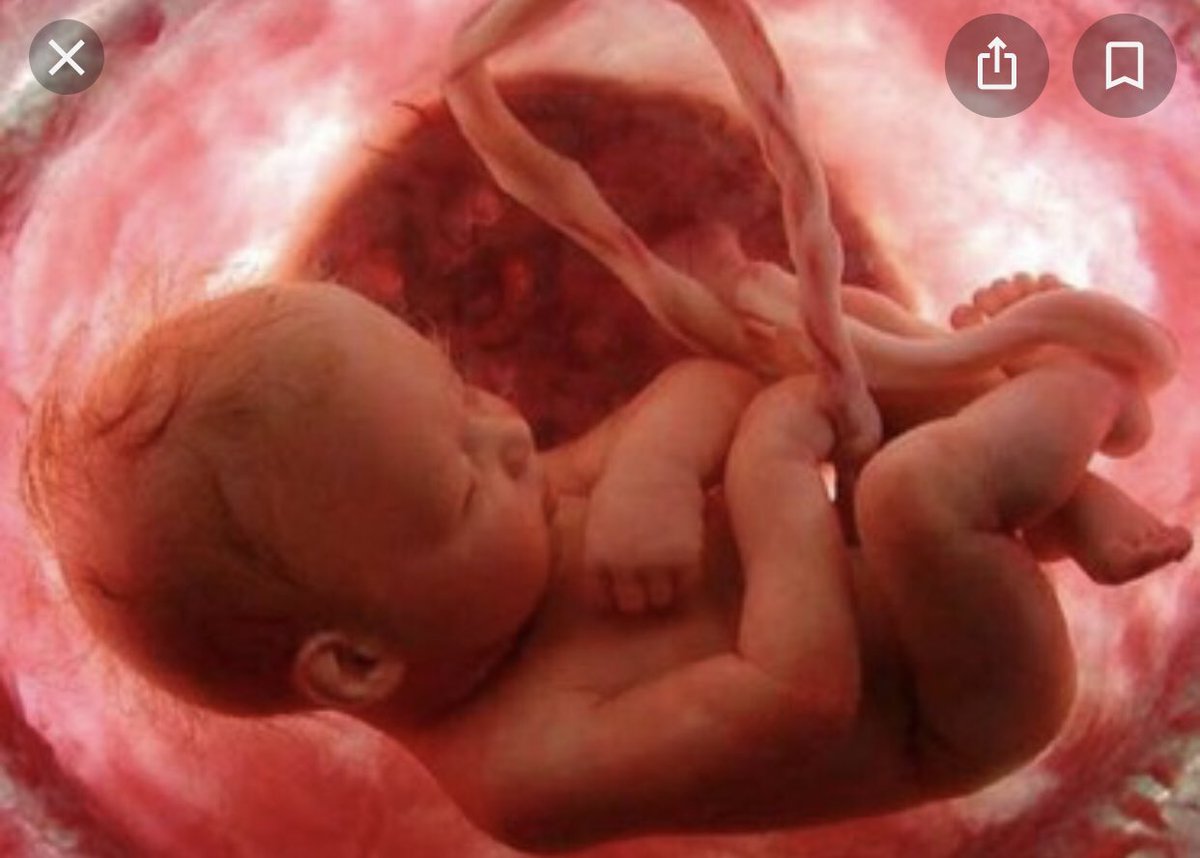 adrenaline1001's tweet photo. Horrible piège Loi #bioéthique pour tuer un bébé de 9 mois pour "détresse psychosociale"?.. (jamais vérifiée)
 Amendement adopté «à la sauvette en pleine nuit» qui détourne le dispositif de l’#IMG (permis pendant 9 mois) quand le délai de l’#IGV est passé.
https://t.co/sHy37ziUhw https://t.co/iitMhRzMHQ