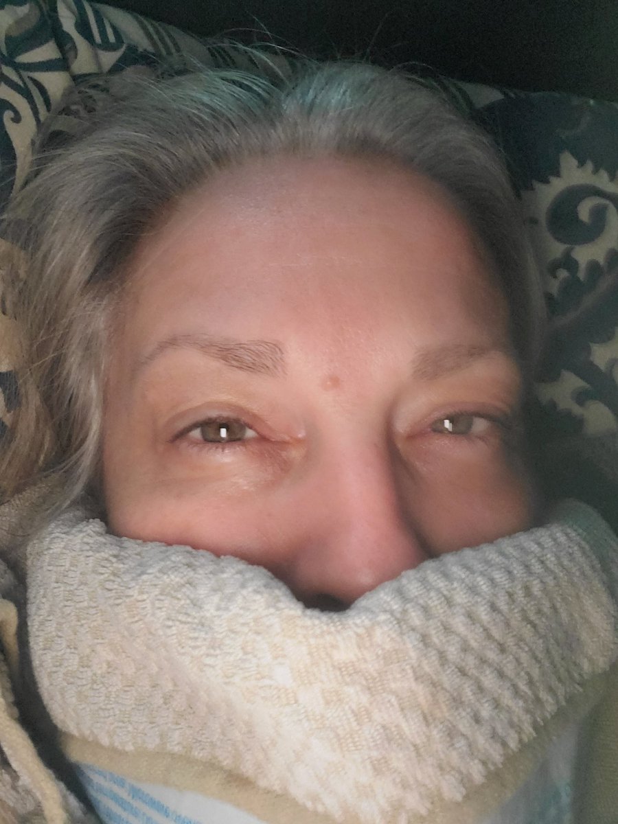 Ice pack to start the day.Owwww.