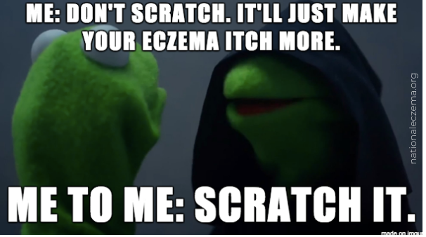 nationaleczema's tweet photo. “Sometimes it itches so bad that I don’t even realize I’m scratching."
Dr. Gil Yosipovitch explains why #eczema itches so much, and what you can do about it: https://t.co/Epnuikp1mY
#theitchthatrashes #itchingforacure #atopicdermatitis #eczemameme https://t.co/eGXjk84p9f