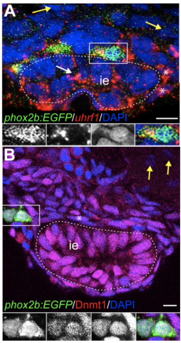 Dev_Bio_Journal's tweet photo. #DBfeatures #DBthrowback #DevBio #ICYMI #gut #zebrafish 🐟

"Epigenetic factors Dnmt1 and Uhrf1 coordinate intestinal development" by Julia Ganz @BrainyFishGuts et al in our Nov 15, 2019 issue.

Check it out here -> https://t.co/rFZmXLd50a https://t.co/EnrkEqC1ZG