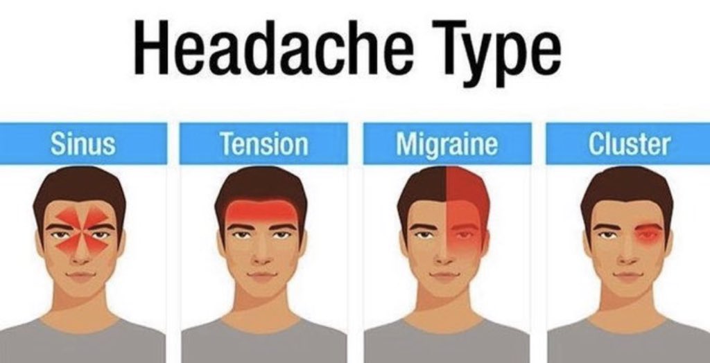 Hipertansiyon ile baş ağrısının lokalizasyonu