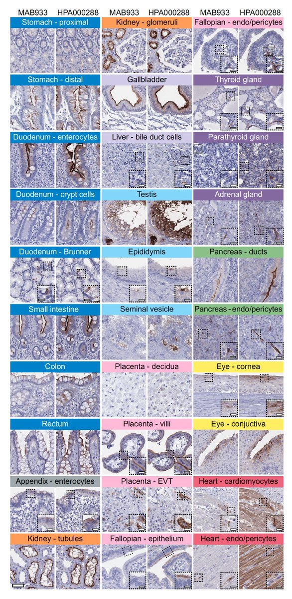 This tropism translates to its ability to bind ACE2 wherever it is expressed in the body 3/x https://embopress.org/doi/10.15252/msb.20209610…  @MolSystBiolA brilliant synthesis of pan-body data, by  @DrLindskogand colleagues  @UU_University