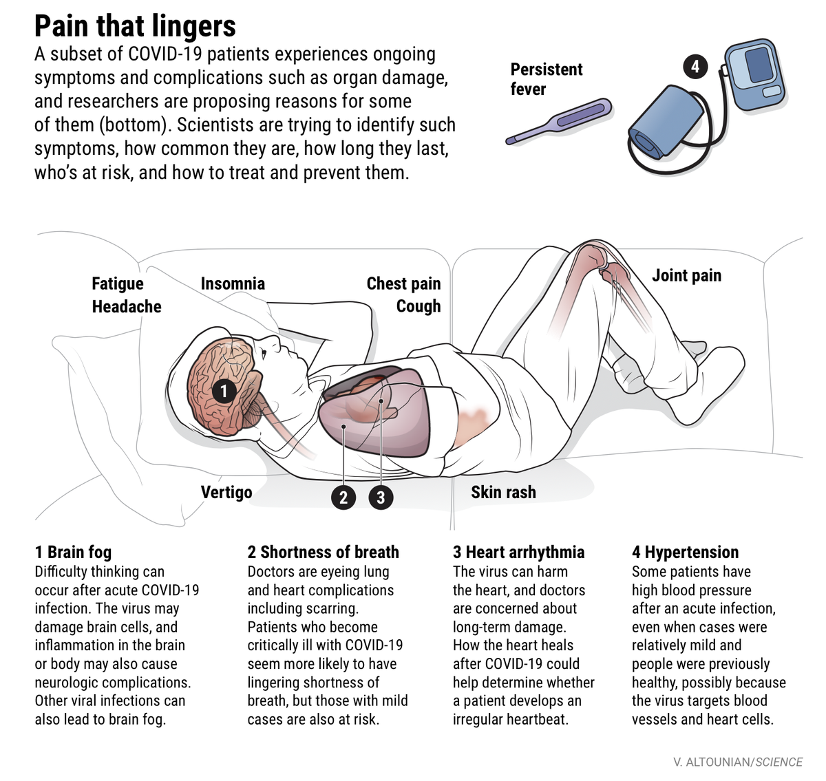 Then there's the chronic, enduring, debilitating symptoms for what is now known as  #LongCovid (aka long haulers) for which there's still much more to learn, but all of that was just reviewed by  @jcouzin  @ScienceMagazine 8/x https://www.sciencemag.org/news/2020/07/brain-fog-heart-damage-covid-19-s-lingering-problems-alarm-scientists