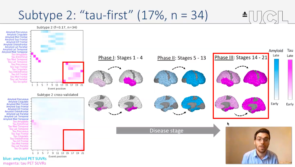 PTenigma's tweet photo. When a DISEASE like #Alzheimer's has many SUBTYPES - how do you disentangle a patient's SUBTYPE+disease STAGE? Dr Alexandra Young's remarkable SuStaIn algorithm shows how: Dr Leon Aksman ties tau-1st and amyloid-1st #Alzheimer's to CSF predictors #AAIC20 https://t.co/1Vxj2tYFml https://t.co/ZMxqc89cYk