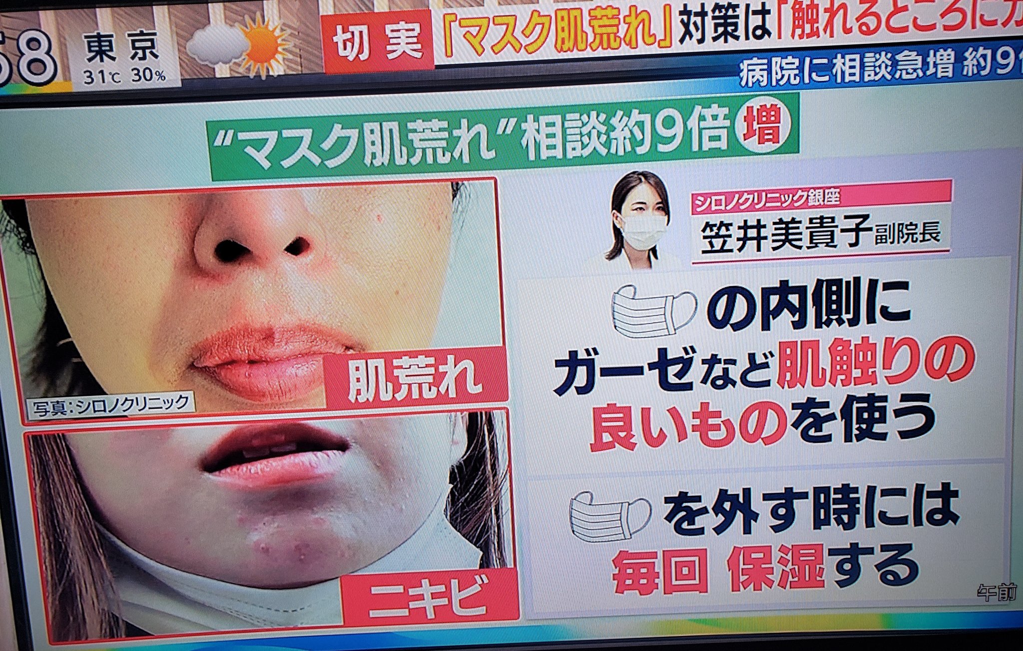みゆ マスク肌荒れ マスクして擦れて肝斑 シミ が濃くなるという恐ろしさ マスク頭痛 マスク外す時には毎回保湿か ミスト系のよさそう スプレータイプのあるし マスク肌荒れ対策は 触れる所にガーゼ と みゆ マスク肌荒れ マスクして擦れて肝斑 シミ が濃くなるという恐ろしさ マスク頭痛 マスク外す時には毎回保湿か ミスト系のよさそう スプレータイプのあるし マスク肌荒れ対策は 触れる所にガーゼ と