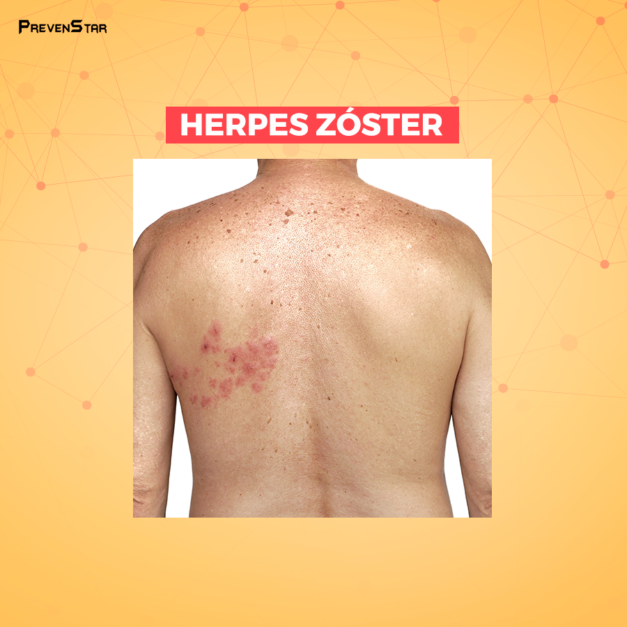 PrevenStar tweet picture