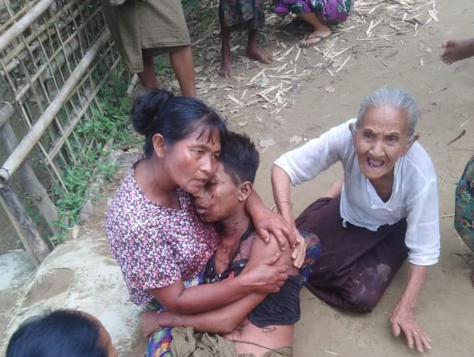 Unexploded artillery shell kills two teenagers and injures four others in Rathedaung 
narinjara.com/news/detail/5f…