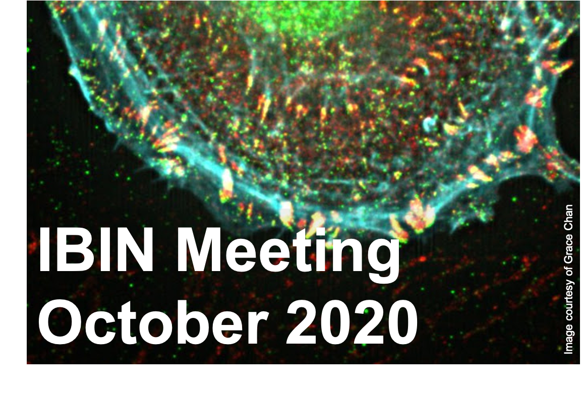 3DBioImaging's tweet photo. 🗣️Help us shape the next IBIN "meeting"!

💰 £25k funding round launch
🔬 3D Bioimaging
🧑‍💻 Short sessions over multiple days
🗓️ October 2020

👇Take 2 mins to register your interest and send us your ideas:
https://t.co/yTTcohT0W6 https://t.co/s0iCKSyDfv
